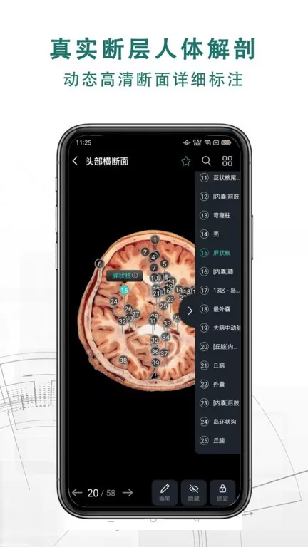 掌上3D解剖安卓免费下载图1